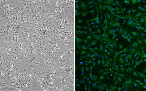 Mouse Hepatic Stellate Cells: MHSC | Cell Applications