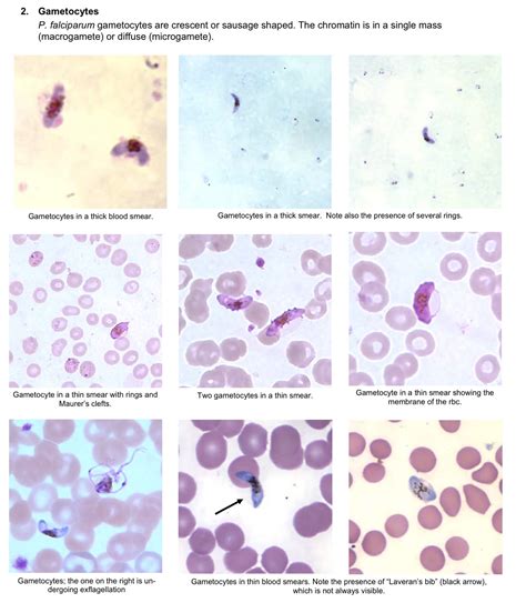 Möglichkeit Patch Wunsch ring stage of malaria Spektrum Unzufrieden Dichter