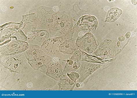 Epithelial Cells In Urine