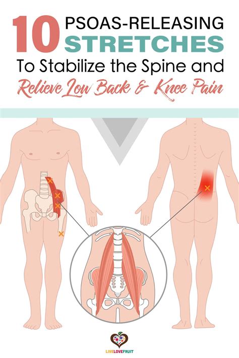 illustration of psoas muscle and trigger points within the psoas muscle ...