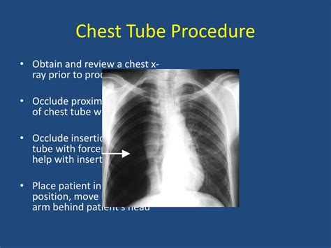 PPT - Chest Tube Insertion and Needle Decompression PowerPoint ...