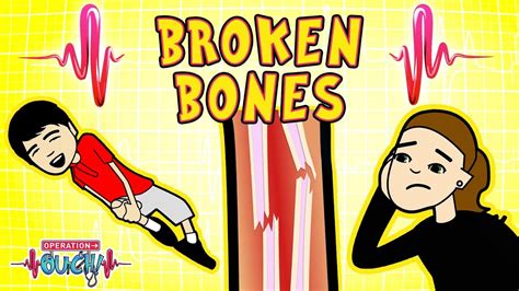 Science for kids | Body Parts - BROKEN BONES | Experiments for kids ...