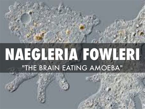 Naegleria Fowleri by Shawn McDonald