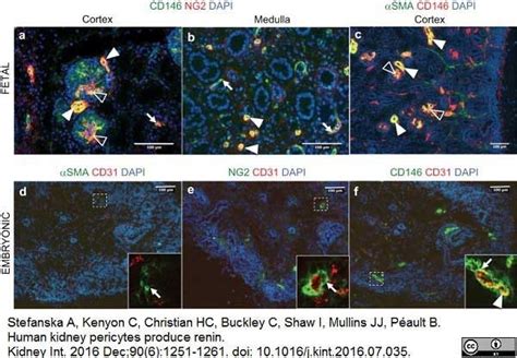 Anti Human CD146 Antibody, clone OJ79c | Bio-Rad