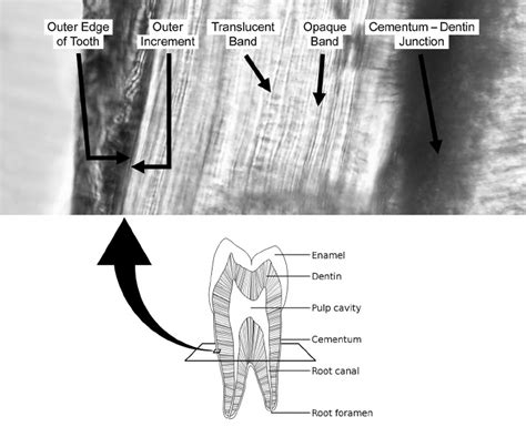 Transverse cross section through middle third of tooth root with... | Download Scientific Diagram