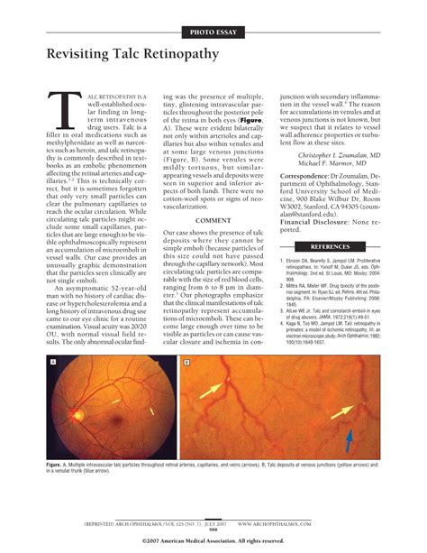 Revisiting Talc Retinopathy | Ophthalmology | JAMA Ophthalmology | JAMA Network