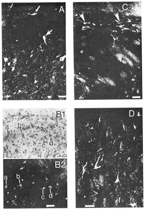 Photomicrographs of labeled neurons in the medullary dorsal horn. A:... | Download Scientific ...