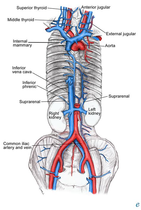 inferior vena cava agenesis - ModernHeal.com