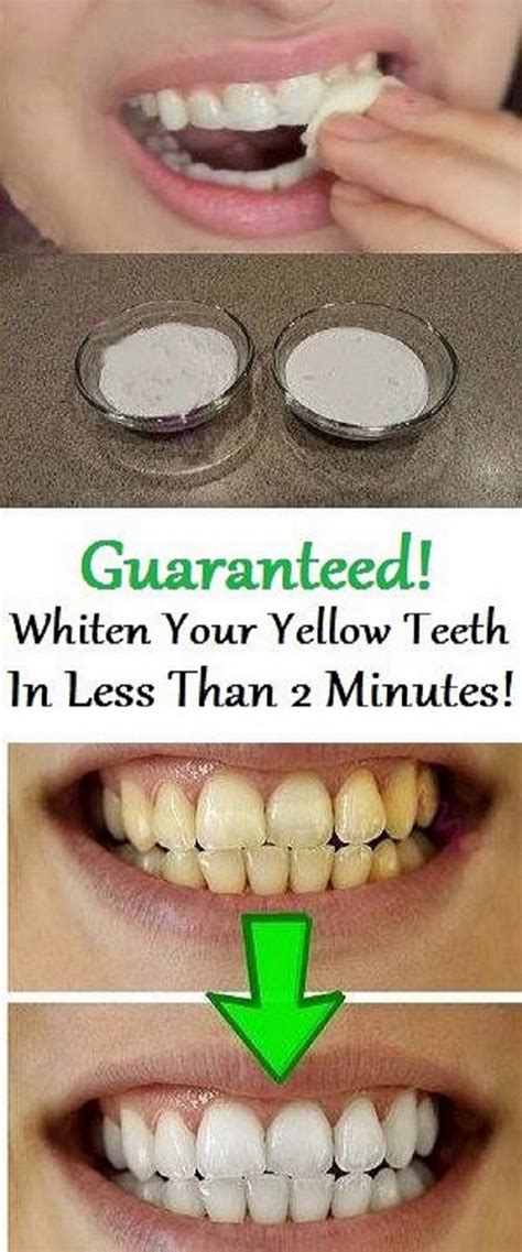 How to Whiten Teeth Naturally at Home