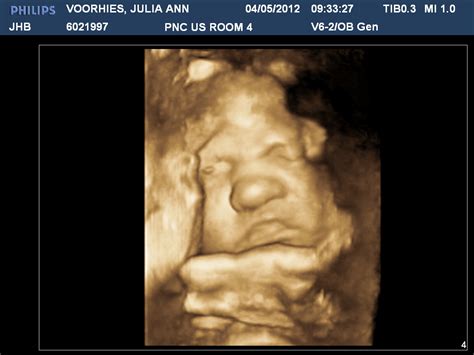 Baby Voorhies: 38 Week Ultrasound