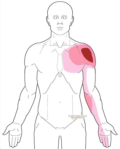 Referred Shoulder Pain Diagram