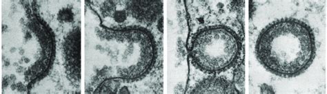 1: Electron microscopy images of clathrin endocytosis. The radius of a... | Download Scientific ...