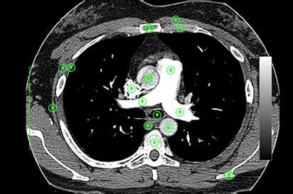 Axial Images, Level 4: CT Scan Overview: Chest -- Health Center ...