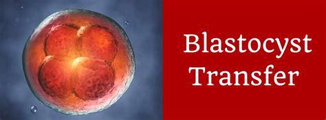 Why is Blastocyst Transfer better than a day 3 Transfer?