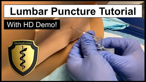 Top 84+ Lumbar puncture animated video - Merkantilaklubben.org