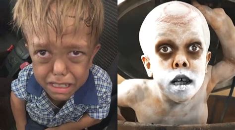 Quaden Bayles, el niño víctima de bullying que se hizo viral y ahora aparece en 'Furiosa: De la ...