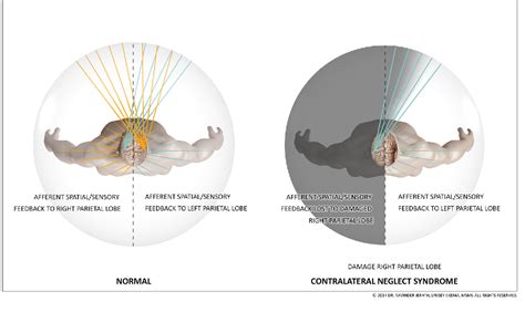 Figure 4 from Neural correlates of visuospatial consciousness in 3D default space: Insights from ...