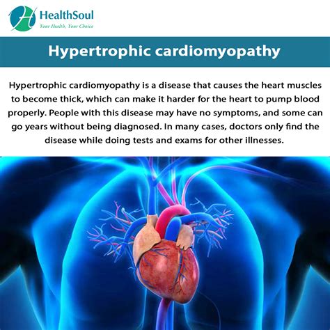 Hypertrophic Cardiomyopathy – Healthsoul