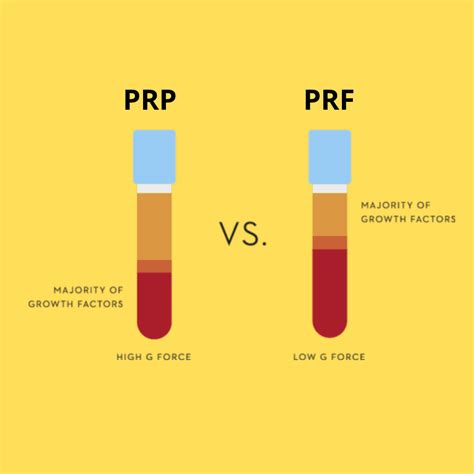 PRF vs PRP: PRF stands out as superior compared to PRP