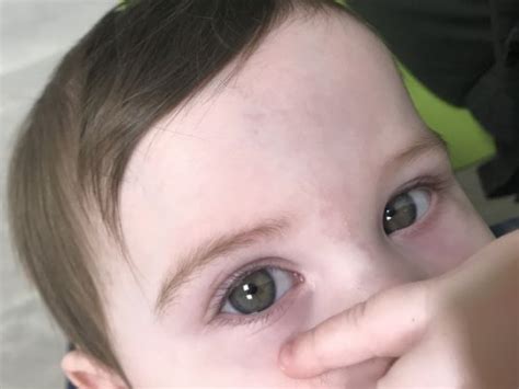 Eyes still grey at 5 months? - February 2018 Birth Club - Page 3 ...