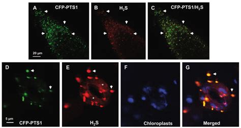 Peroxisomes Types - Neva Site