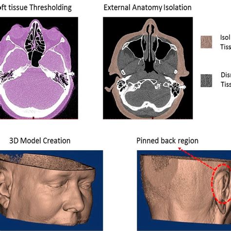 Various stages of the final silicone prosthesis production. (a)... | Download Scientific Diagram