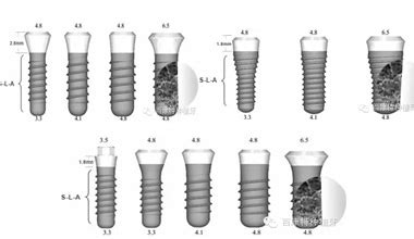 100% ITI Starumann Compatible - Quality Dental Implant Online Shop