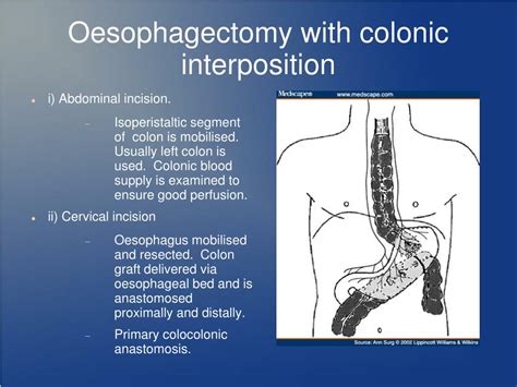 Colocolonic Anastomosis : Laparoscopic EEA Colorectal Anastomosis for ...