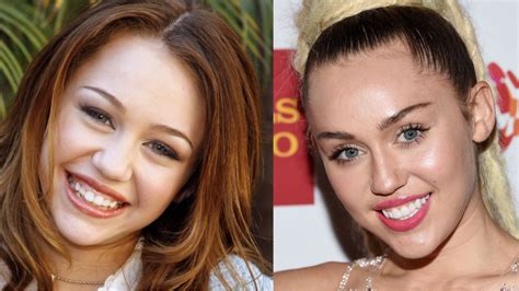 5 Unbelievable Celebrity Dental Transformations!