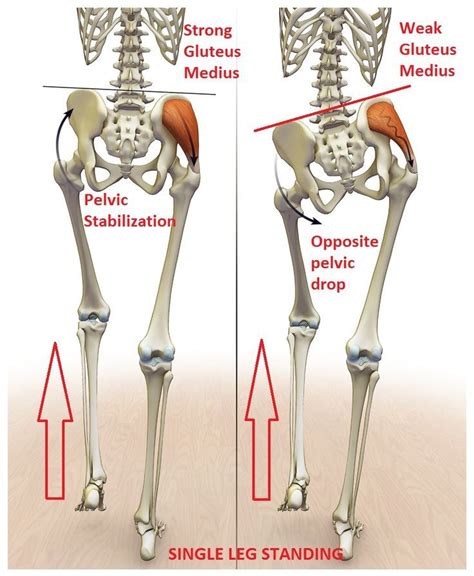 Gluteus Minimus Strain - fingersandfeathersh