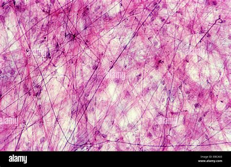 Collagen Connective Tissue