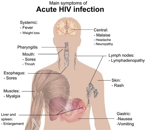 File:Symptoms of acute HIV infection.png - Wikipedia, the free encyclopedia