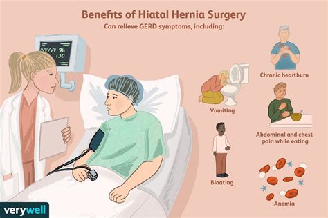 Hiatal Hernia Surgery: Long-Term Care