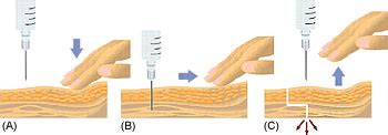 Parenteral Administration (Injectable)