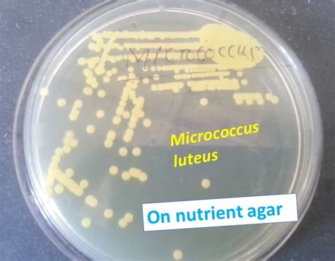 Nutrient agar: Introduction, Composition, Preparation, Test Procedure