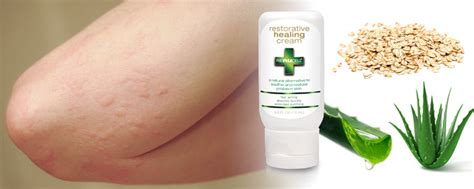 Top Remedies for Skin Rash – REnuCELL®