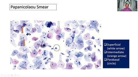 GAME 53 | Pap smear | Exfoliative cytology | Practical | Charts & slide | SRM | Dr GSS | Univ ...