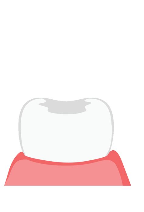 Health Medicine Animated Clipart-animated germs attacking teeth animated clipart