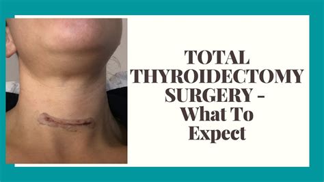 TOTAL THYROIDECTOMY SURGERY || THYROID CANCER SYMPTOMS IN WOMEN || MELISSA MARIE - YouTube