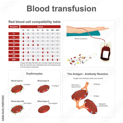 Blood transfusion. There are two special blood types when it comes to ...