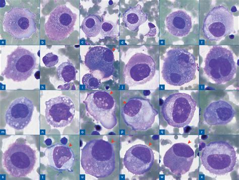 The panorama of different faces of mesothelial cells | Basicmedical Key