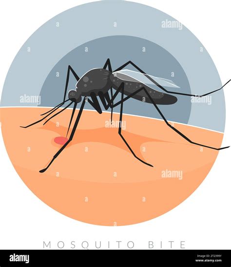 Mosquito biting on Human Skin - Stock Illustration as EPS 10 File Stock Vector Image & Art - Alamy