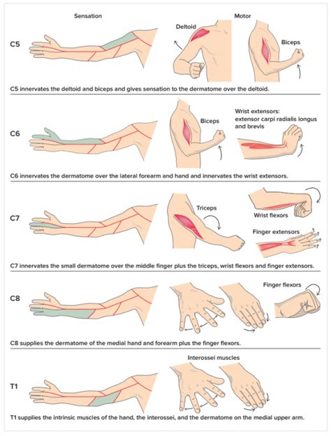 c5 c6 C5 RADICULOPATHY - Google 搜尋 in 2020 | Physical therapy student ...