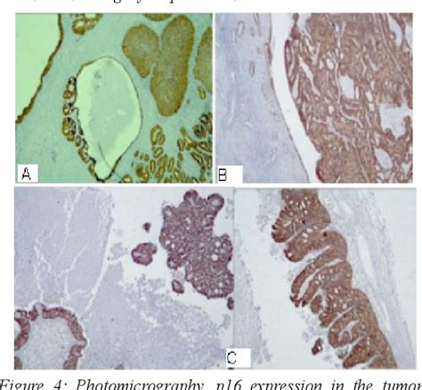 Figure 1 from Pathohistological and Immunohistochemical Characteristics ...