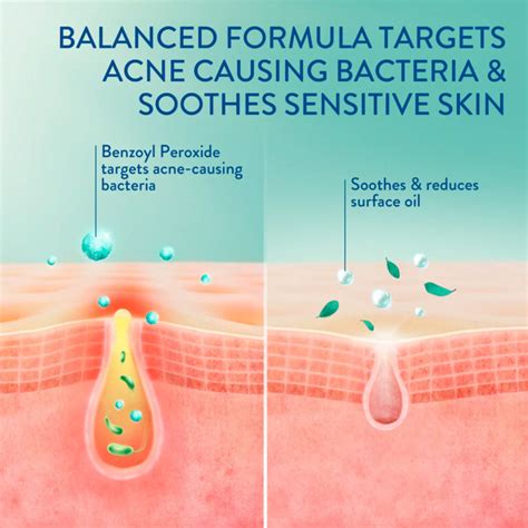 Cetaphil Gentle Clear BPO Acne Cleanser for Sensitive Skin - Spa Body Center