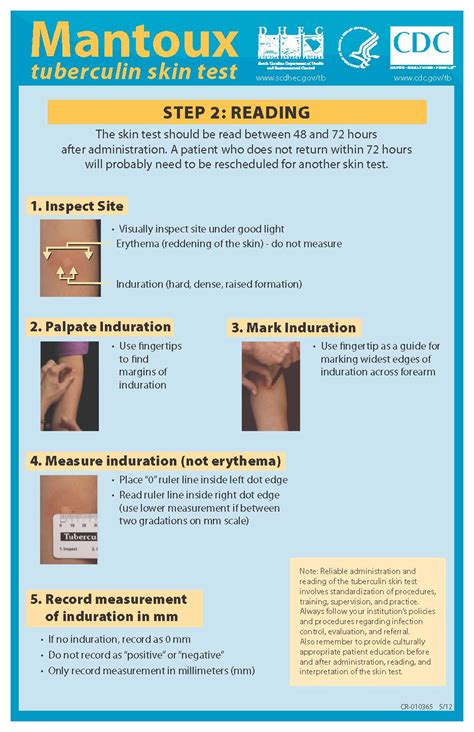 Tuberculin Skin Test Ruler Printable