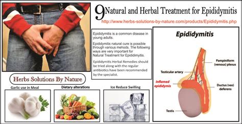 9 Natural and Herbal Treatment for Epididymitis | Herbal treatment, Herbalism, Treatment