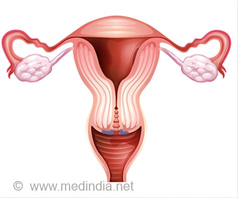 LEEP (Loop Electrosurgical Excision Procedure) - Indications ...