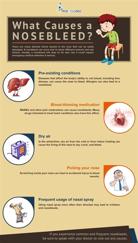 Nose Bleed: Causes, Diagnosis, and Treatment | FindATopDoc