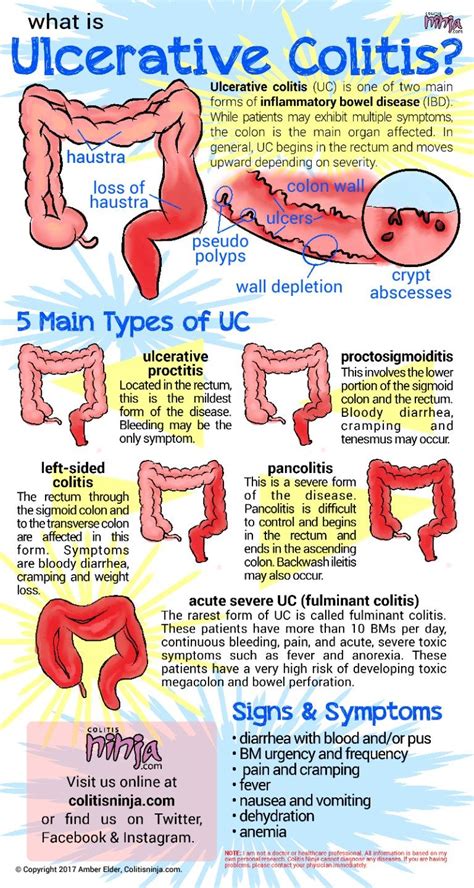 ulcerative colitis Nursing School Studying, Nursing School Notes, Nursing Study, Nursing Tips ...